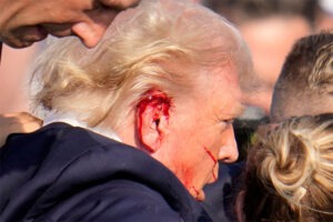 Trump, Seared With Scars - status of Trumps wounded ear